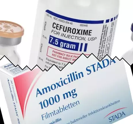 Cefuroxime vs Amoksisilin